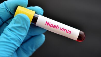 219058 nipah virus