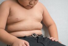 0.72426200 1485772923 obese kid
